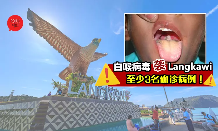 Langkawi爆發白喉疫情⚠️證實有3病例, 嚴重可致死亡❗近期去玩的要小心注意❗