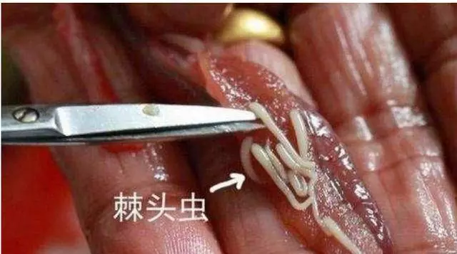 醫生忠告:別再吃5種食物了,含有太多的寄生蟲、病菌,比馬桶都髒