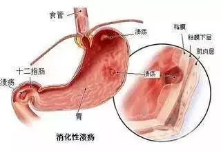 生什麼病,忌什麼口,留著這張表,不用看醫生~