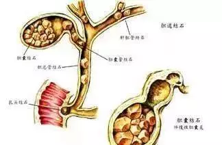 生什麼病,忌什麼口,留著這張表,不用看醫生~