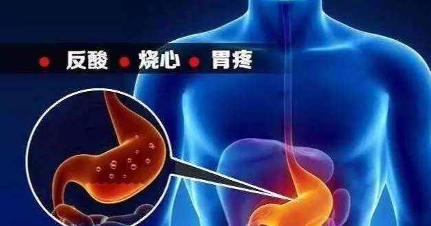 按1按手心窩、再吃10顆花生米,胃反酸、打嗝、噯氣,通通可緩解