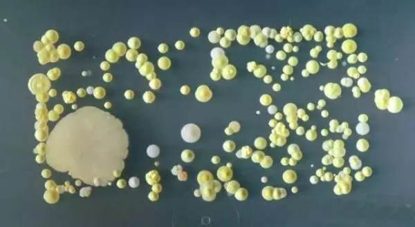 孩子不愛刷牙?把髒牙齒放大1000倍的圖片給他們看,我就不信他不刷牙!