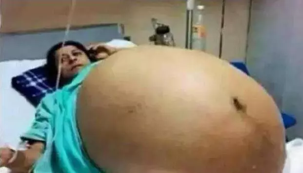 17歲少女產下十一胞胎,她的父母最後說出了「多子」的真相