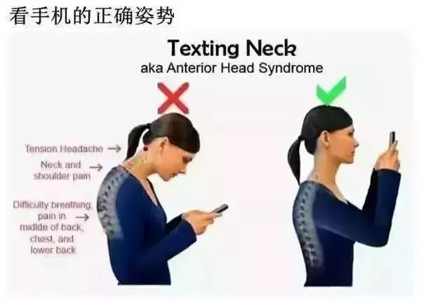 頸椎病分10級,超過2級就要注意了!一分鐘測試頸椎問題