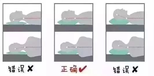 頸椎病分10級,超過2級就要注意了!一分鐘測試頸椎問題