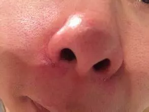 醫生:出現7個癥狀,證明你有了肝病 ,調理肝臟並不難,只需堅持一戒二吃三動