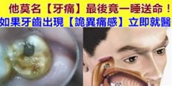 他莫名「牙痛」最後竟一睡送命,如果牙齒出現「詭異痛感」立即就醫,這是四種惡病來襲徵兆