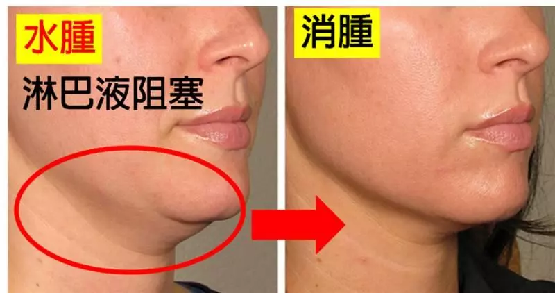 人體三處淋巴決定老年人健康,學會淋巴按摩,隨時隨地能救命