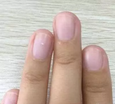 年過五十歲,應該清理腎臟了,每天做三分鐘【養腎操】,記憶力都變好了