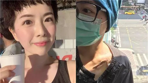 肚痛竟罹卵巢癌!部落客含淚切子宮竟被小三嗆爆:我比妳健康