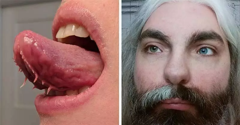 20個「不同於凡人」的稀有基因!一起來看看這些大自然在人體上創下的奧妙吧。