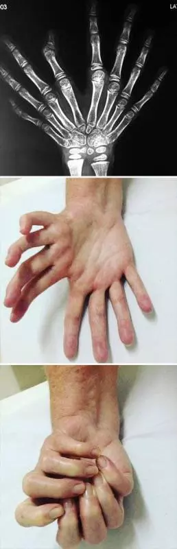 20個「不同於凡人」的稀有基因!一起來看看這些大自然在人體上創下的奧妙吧。