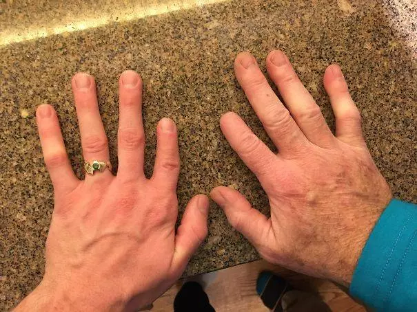 20個「不同於凡人」的稀有基因!一起來看看這些大自然在人體上創下的奧妙吧。