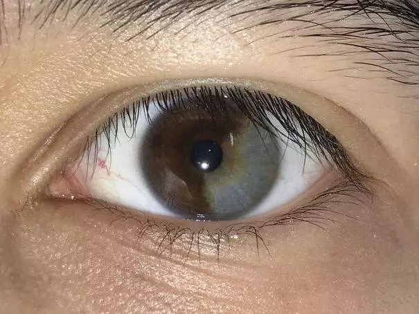 20個「不同於凡人」的稀有基因!一起來看看這些大自然在人體上創下的奧妙吧。