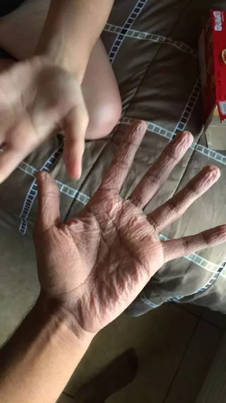 20個「不同於凡人」的稀有基因!一起來看看這些大自然在人體上創下的奧妙吧。