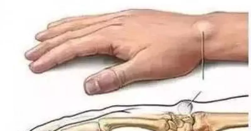 拉開身上「筋結」體內百病去。專家獨門拉筋法,8~80歲都適用!!!