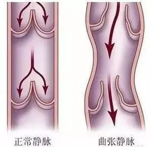 拉開身上「筋結」體內百病去。專家獨門拉筋法,8~80歲都適用!!!