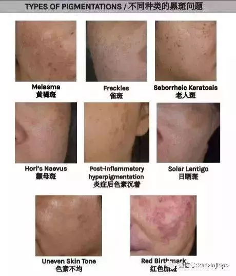 在新加坡月入5000的我,為什麼比女傭的皮膚還差