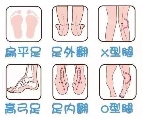 6種暢銷涼鞋會把孩子推向危險的邊緣,再好看媽媽也別給孩子穿