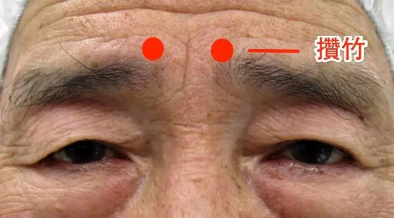 神奇的一分鐘治療法,對不起各位醫生了啊! !
