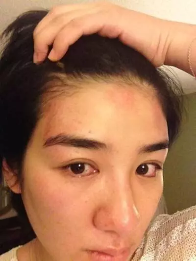 太慘了! 盤點那些被毆打過的明星, 張藝謀打骨折, 陳冠希成豬頭, 楊冪很可憐!