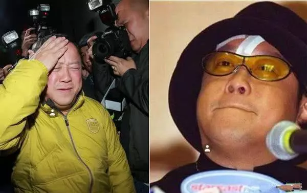 太慘了! 盤點那些被毆打過的明星, 張藝謀打骨折, 陳冠希成豬頭, 楊冪很可憐!