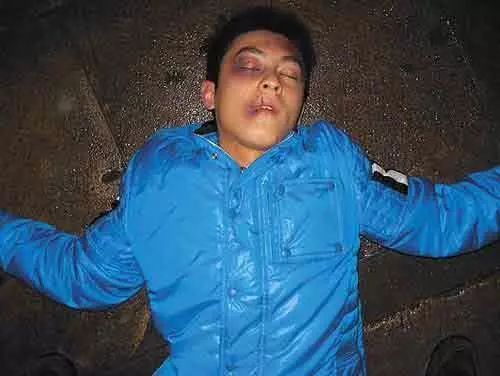 太慘了! 盤點那些被毆打過的明星, 張藝謀打骨折, 陳冠希成豬頭, 楊冪很可憐!
