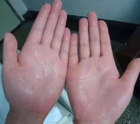 男孩腎髒「虛透」不承認?別費力氣遮掩,3處大冒汗已經表明一切