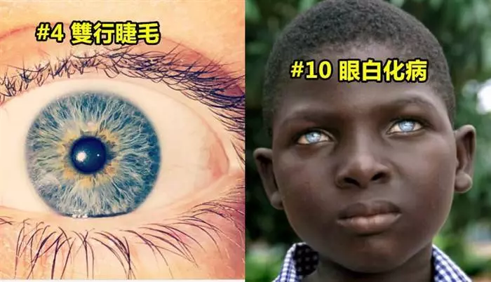 11個基因突變而導致他們與眾不同的人類!
