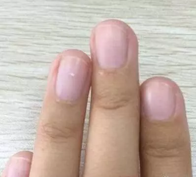 年過五十歲,應該清理腎臟了,每天做三分鐘【養腎操】,記憶力都變好了