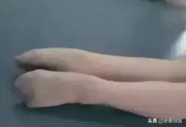 「足背拉一拉,活到九十八」老中醫絕學之經絡篇