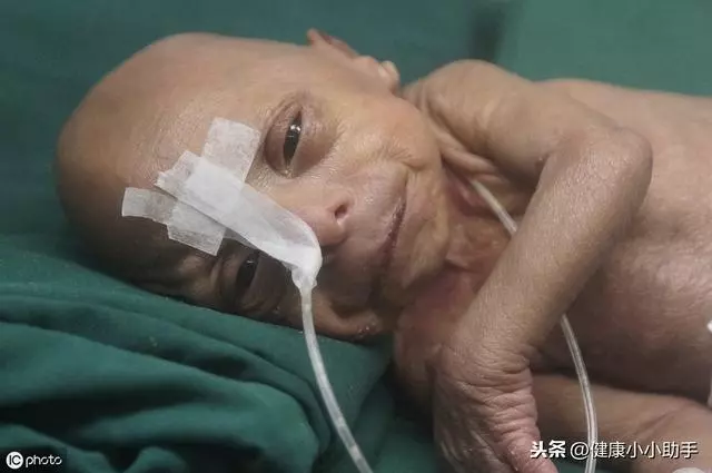 高血壓的3大危害你知道嗎?1種葉子泡水喝,降壓、降脂、軟化血管