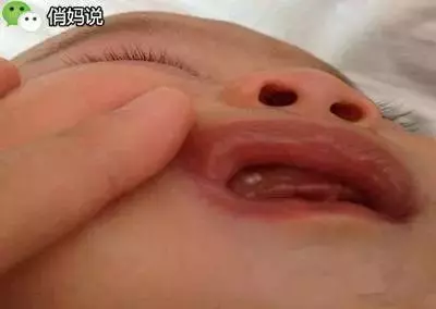 藏在寶寶身上的7個「小秘密」,無數爸媽至今不知道真相!