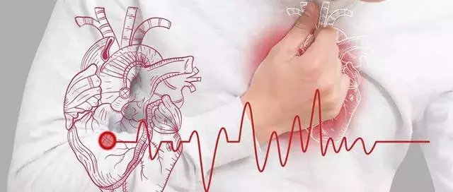 血管幹凈人長壽!做好3件事,讓心腦血管疾病遠離你