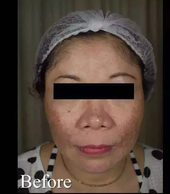 在新加坡月入5000的我,為什麼比女傭的皮膚還差 !?