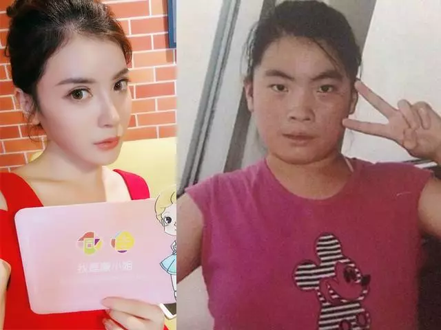 三天就被追一次!醜女整容13次終變美,人生反轉 !