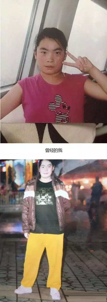 三天就被追一次!醜女整容13次終變美,人生反轉 !