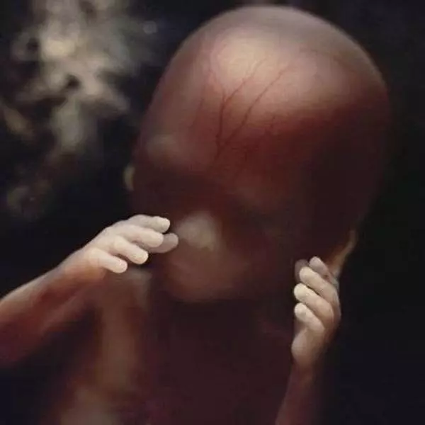 花12年拍「子宮裡的世界」 瑞典攝影師完整紀錄生命「從零到有」的過程