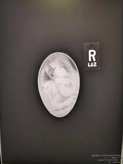 20張充滿驚喜的X光照片!懷孕貓媽肚子裡滿滿小喵!