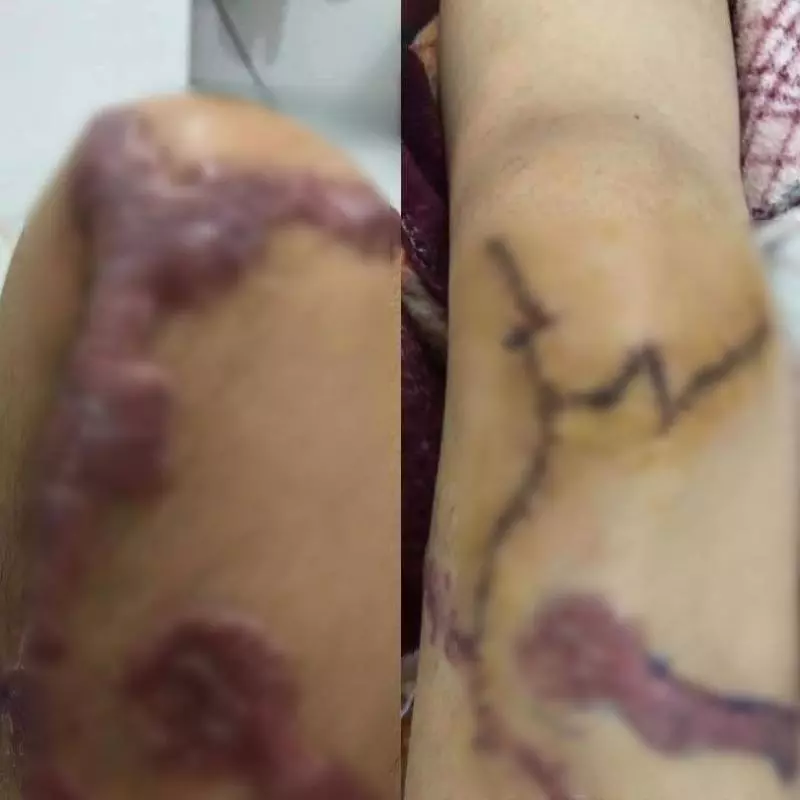 警官綠火中燒！鏹水淋新婚妻子