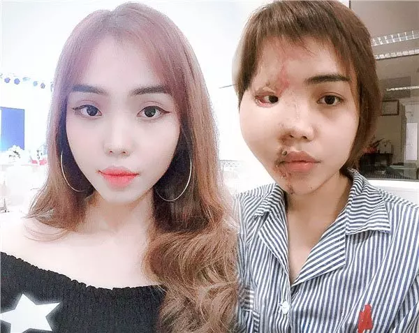 警官綠火中燒！鏹水淋新婚妻子