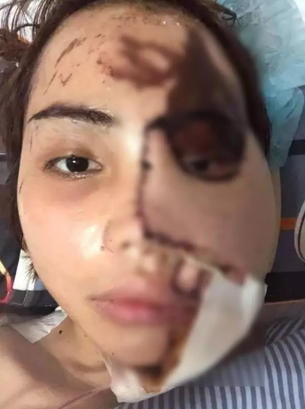 警官綠火中燒!鏹水淋新婚妻子 !