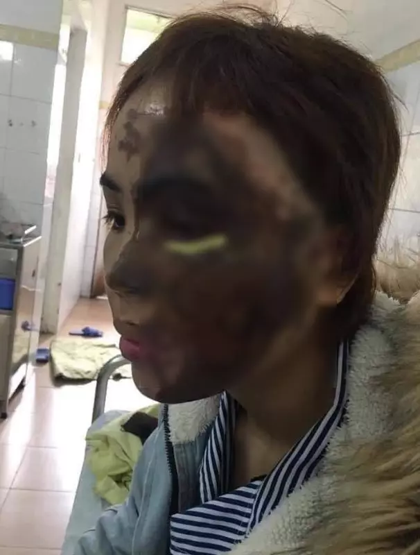 警官綠火中燒!鏹水淋新婚妻子 !