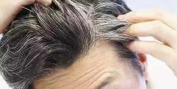 白髮為何越長越多?原因可能就出在這裡,為了健康多了解下