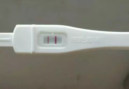 17歲小女生已懷孕14週,婦科醫生看著超音波圖卻無法說出恭喜