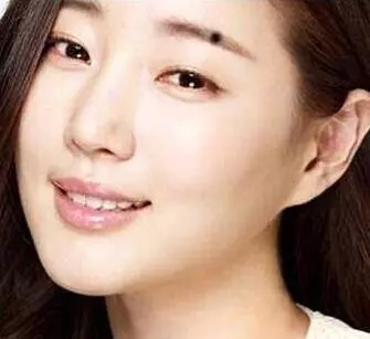 女人臉上的七顆幸運痣不能點,財運好,又旺夫,婚後最幸福