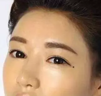 女人臉上的七顆幸運痣不能點,財運好,又旺夫,婚後最幸福