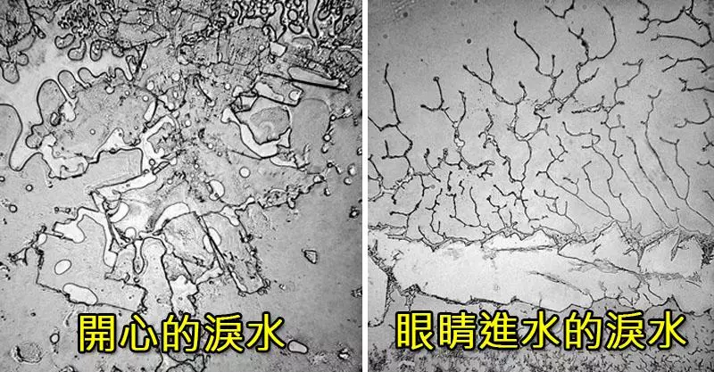 9種透過顯微鏡拍下因各種情緒流下的眼淚結晶