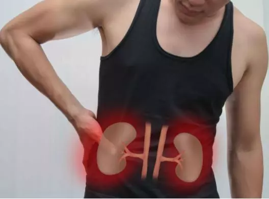 醫生提醒:牢記4個方法能讓你的腎變好,可你好像一種都做不到