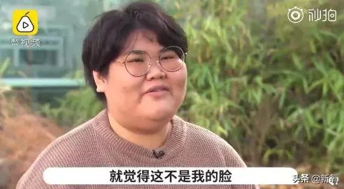 小狐狸腦袋卡垃圾桶蓋子上進出不得,等救援